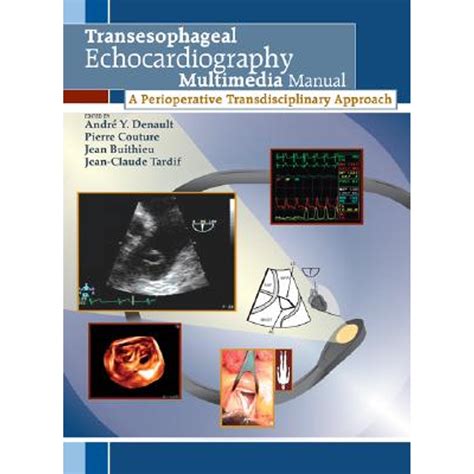 Transesophageal Echocardiography Multimedia Manual A Perioperative Transdisciplinary Approach Epub