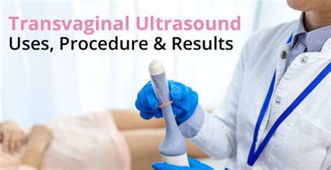 Transvaginal Ultrasound Epub