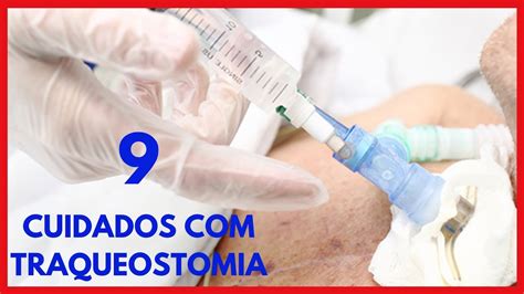 Traqueostomia Metálica: Um Guia Abrangente de Procedimentos, Cuidados e Benefícios