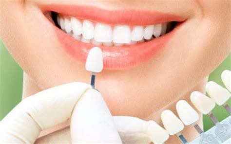 Tratamento Ortodôntico: Um Guia Completo para um Sorriso Perfeito