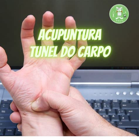 Tratamento do Túnel do Carpo: Um Guia Completo para Aliviar a Dor e o Desconforto