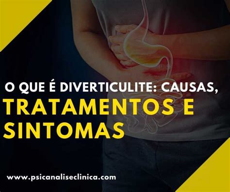 Tratamento para Diverticulite: Um Guia Abrangente