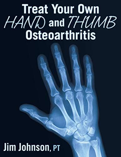 Treat Your Own Hand and Thumb Osteoarthritis Reader