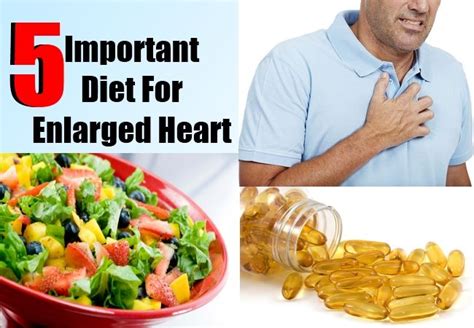 Treatment for Enlarged Heart: A Guide to 7 Proven Remedies