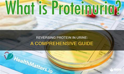 Treatment for Protein in Urine: A Comprehensive Guide to Beat "Proteinuria"