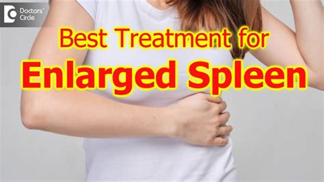 Treatment for an Enlarged Spleen: 8 Cutting-Edge Options