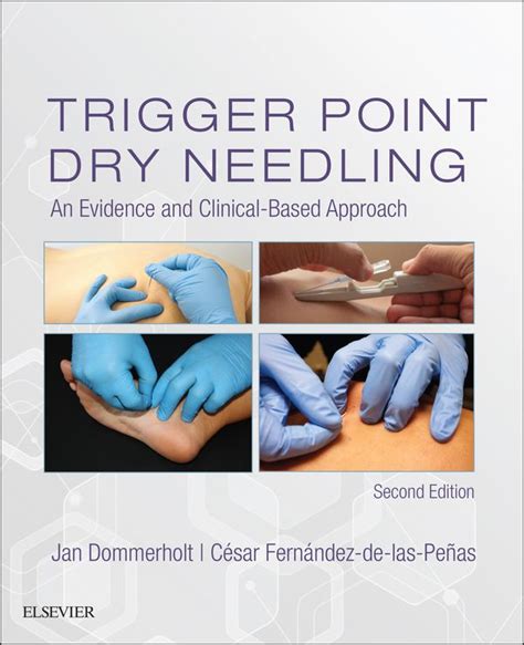 Trigger Point Dry Needling: An Evidence and Clinical-Based Approach (Hardcover) Ebook Doc