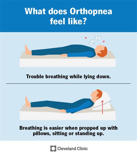 Trouble Breathing When Lying Down: A Comprehensive Guide to Orthopedic Dyspnea