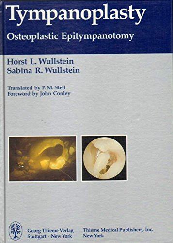 Tympanoplasty Osteoplastic Epitympanotomy Reader