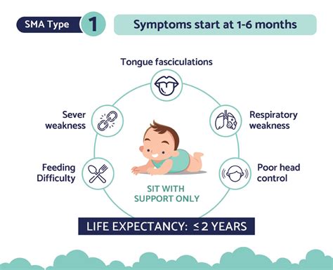 Type 0 (Infantile-Onset SMA)