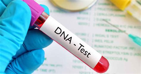 Types of ADN Tests