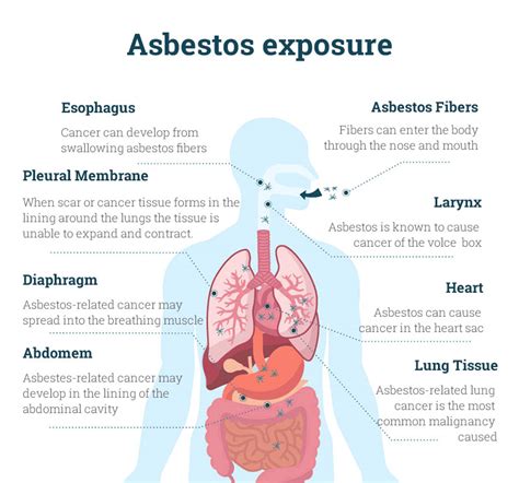 Types of Asbestos-Related Diseases