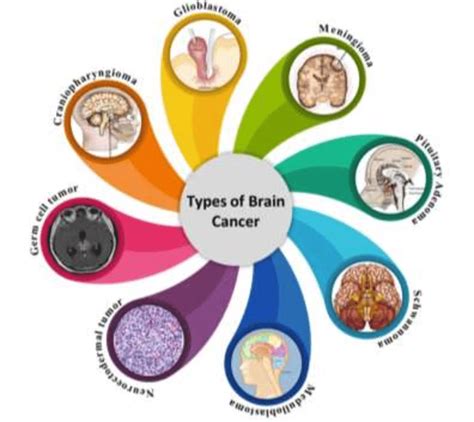 Types of Brain Cancer