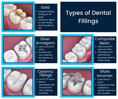 Types of Filling Materials