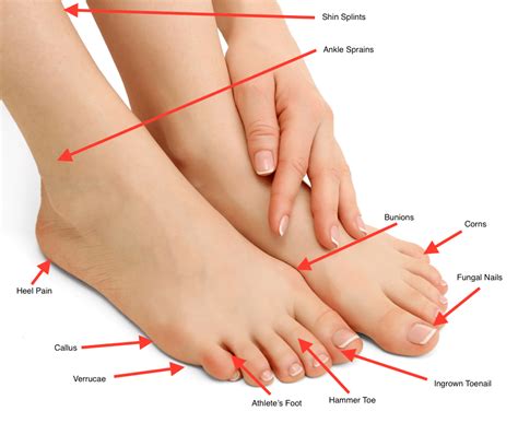 Types of Foot Problems