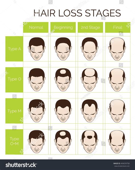 Types of Hair Loss Toppers