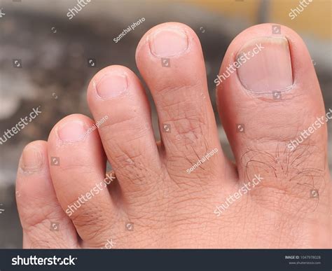 Ultimate Guide to Healthy Toes and Nails: A Comprehensive Resource