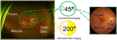 Ultra-Wide Field of View: