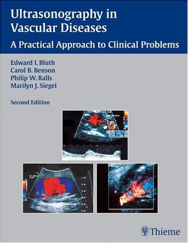 Ultrasonography in Vascular Diseases A Practical Approach to Clinical Problems 2nd Edition Epub