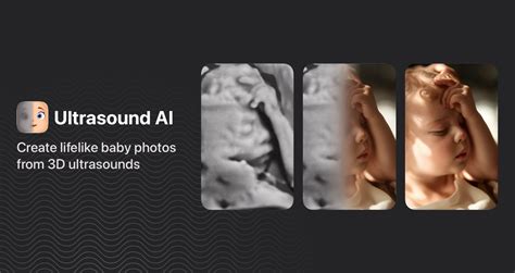 Ultrasound AI Generator: 50,000+ Images & 10,000+ Annotations