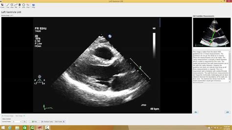Ultrasound Teaching Cases Kindle Editon