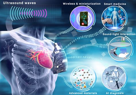 Ultrasound monitoring: