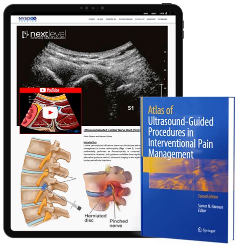 Ultrasound-Guided Procedures PDF