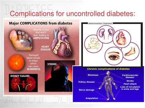 Uncontrolled Diabetes