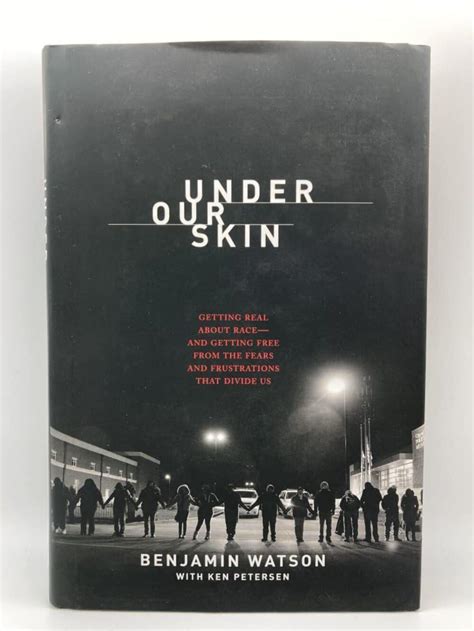 Under Our Skin Getting Frustrations Reader