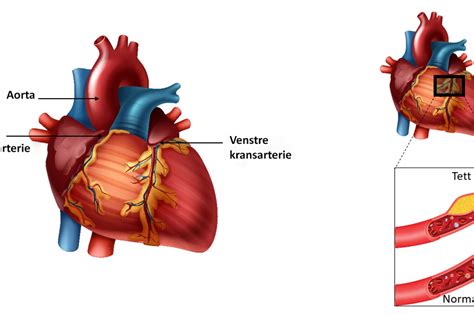 Undersogelser Over Hjertets Phosphatider Epub