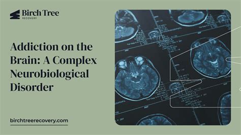Understanding Addiction: A Complex Neurobiological Disease