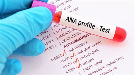 Understanding Ana's Prevalence and Severity