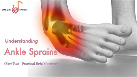 Understanding Ankle Sprains