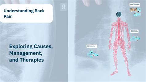 Understanding Back Charts