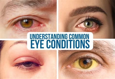 Understanding Common Eye Conditions in Animals