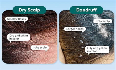 Understanding Dry Hair