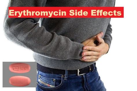 Understanding Erythromycin Fish: A Comprehensive Guide