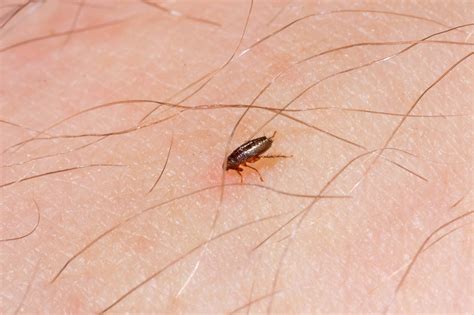 Understanding Flea Bites