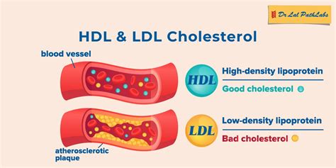 Understanding HDL Cholesterol