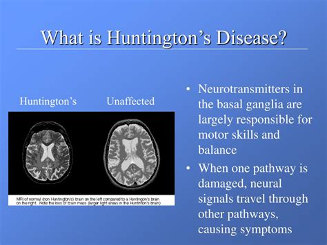 Understanding Huntington Disease