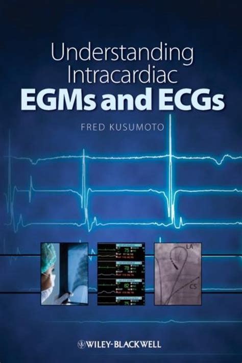 Understanding Intracardiac EGMs and ECGs PDF