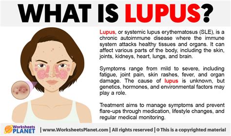 Understanding Lupus Regina