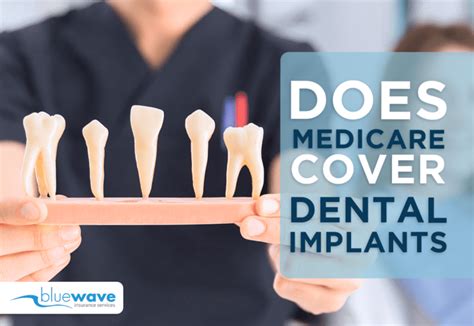 Understanding Medicare Coverage for Dental Surgery: A Comprehensive Guide