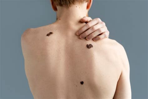 Understanding Moles