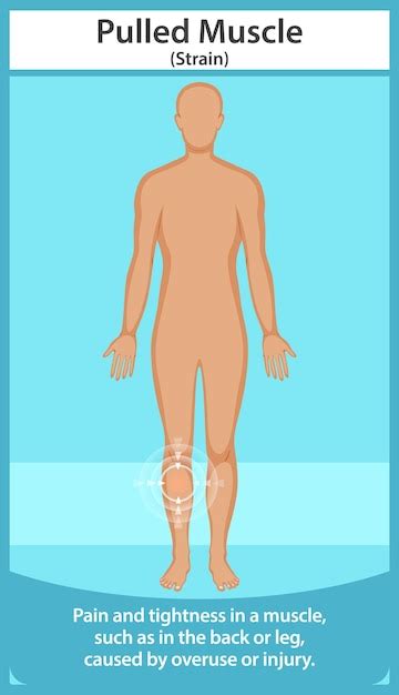 Understanding Muscle Mal