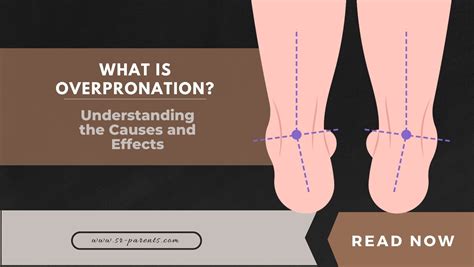 Understanding Overpronation