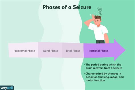 Understanding Postictal Symptoms