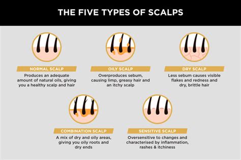 Understanding Scalp Types