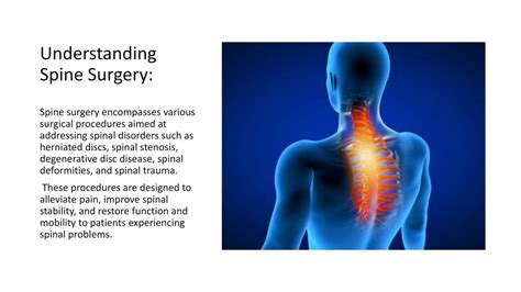 Understanding Spine Surgery