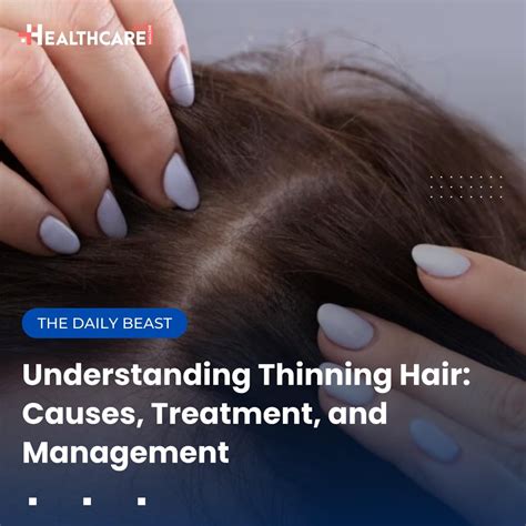 Understanding Thinning Hair: Causes and Concerns